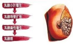 -兰派国际美容养生SPA