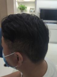 -大麦微针植发丨全国连锁