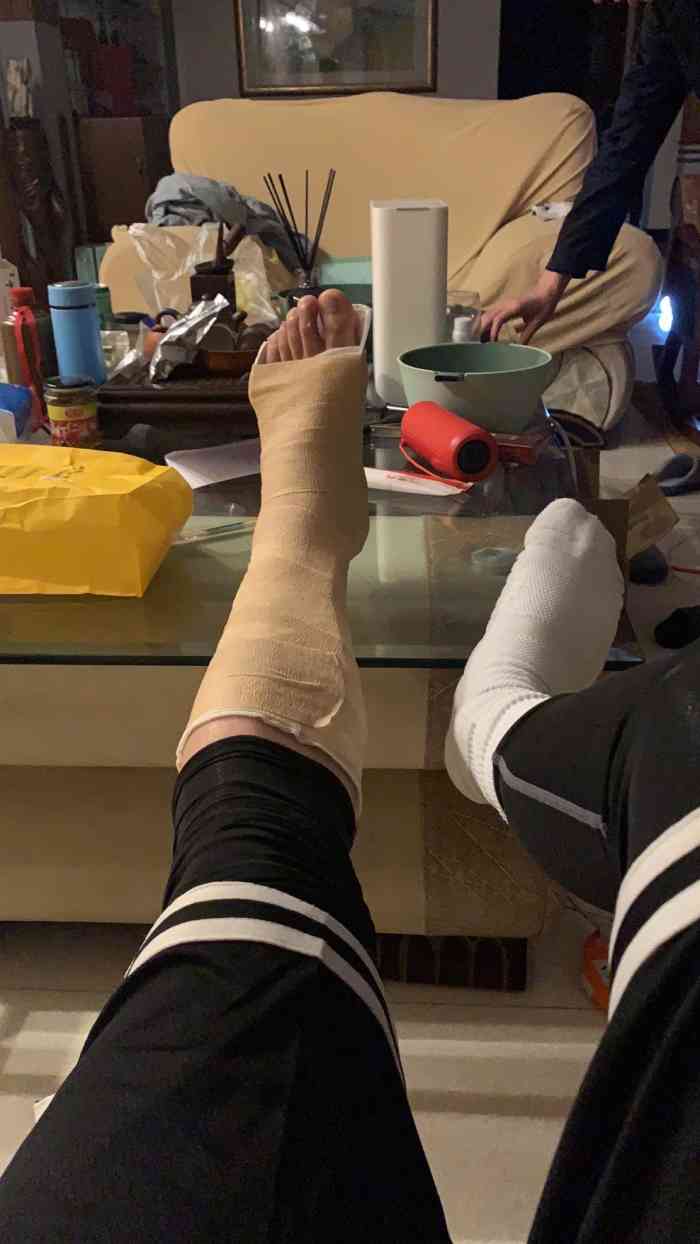 广州市正骨医院-"扭伤好几个月了,还隐隐作痛,有点怕是骨裂.