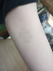 -天道专业洗纹身
