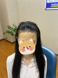 -大麦微针植发全国连锁