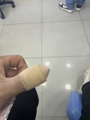 -德哥灰指甲脚气甲沟炎跖疣护理