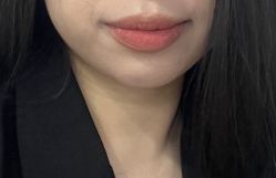 点击看大图 体验前-重庆军科整形美容医院