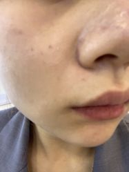 -长沙雅美医疗美容医院