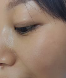 -深圳芙必优医疗美容·抗衰中心