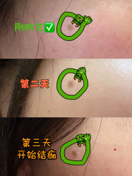 体验后-张小熊连锁轻医美