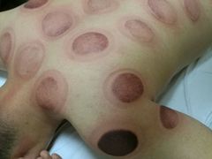 -宜华康盲人按摩(中关村店)