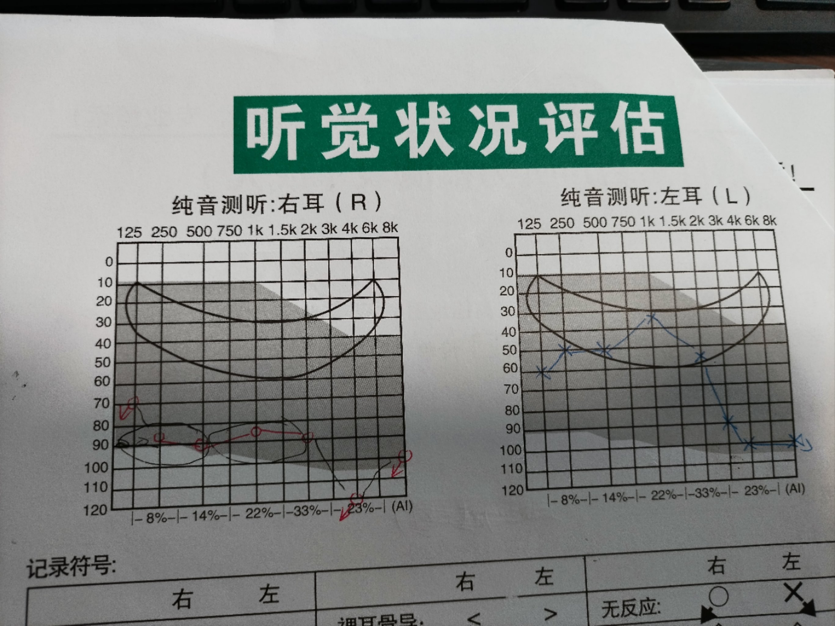 宝宝听力发育图1～12月图片