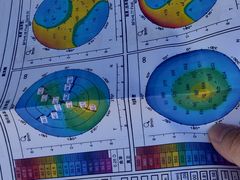 -美尔目眼科医院·近视手术·儿童近视(通州店)