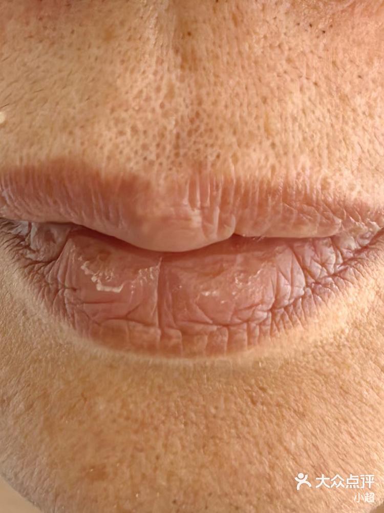 1,唇色发白多是气血不足; 2,唇色深红