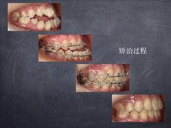 -团圆口腔·种植中心(锦江院区)