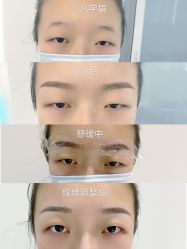 -久匠·纹眉纹绣半永久