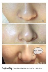 光spa-光SPA科技美肤