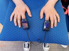 -爱氧森林·日本兴百世SHENPIX微高压氧舱