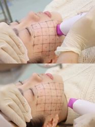 -上海漾颜医疗美容