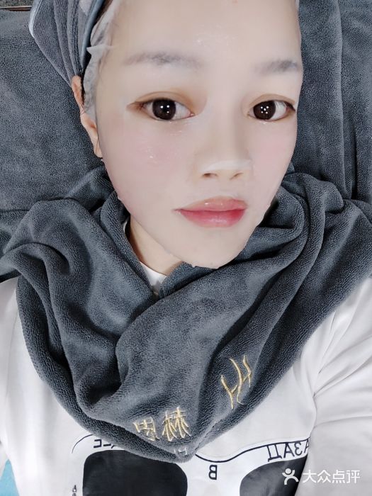 赫思整形医疗体验后图片