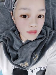 体验后-赫思整形医疗