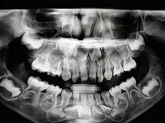 -宁波儿童口腔医院(钱湖院区)