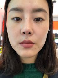 点击看大图 -北京米扬丽格医疗美容·联合丽格鼻整形中心