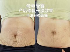 -修申骨雕小颜脊柱骨盆管理产后修复