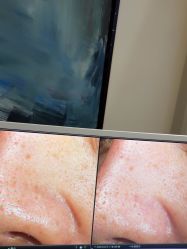 -苑苑vbeauty科技美容SPA