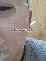 点击看大图 -Yestar宁波艺星整形医院