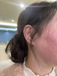 -长沙雅美医疗美容医院