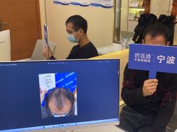 点击看大图 -碧莲盛·不剃发植发