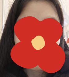 体验后-石家庄苏亚美联臣医疗美容医院