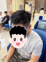 -大麦微针植发全国连锁