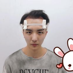 -大麦微针植发丨全国连锁