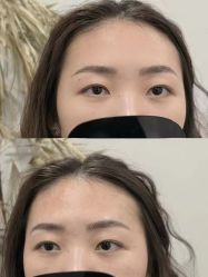 点击看大图 -张小野·专业半永久纹眉