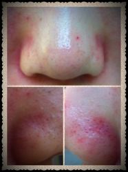 iphone_upload_pic-瑞妍美创美容