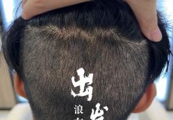 -大麦微针植发全国连锁