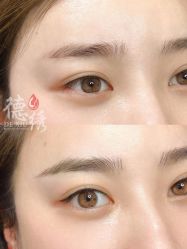 -德绣·机器野生眉发际线·美瞳线半永久