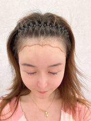 -熙朵美学植发·连锁品牌