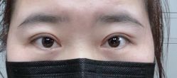 -丰联丽格医疗美容·联合丽格眼整形中心