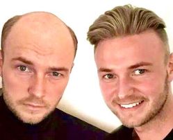 -发饰美男士增发补发假发定制店