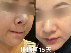 -Cream88颜皮肤管理中心