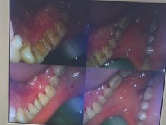 -诺贝尔一诺口腔医院(雁塔院区)