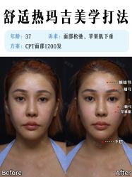-深圳艺星医疗美容医院