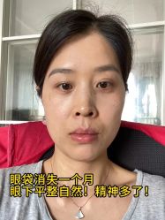 -广州健丽·去眼袋医疗美容机构