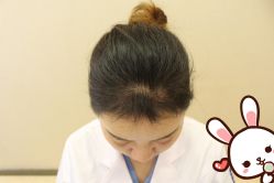 -大麦微针植发丨全国连锁