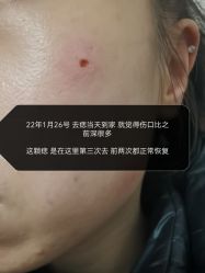 体验后-正璞医疗美容·皮肤修复·微整注射