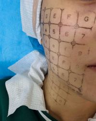 -agge蛋白医美