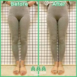 -FACE·日本小颜矫正美容整骨サロン