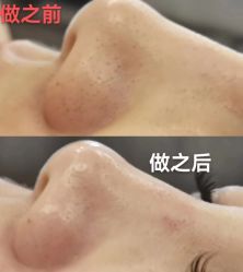 -艾尚妮·美容美体SPA