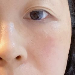 体验后-重庆军美医疗美容医院