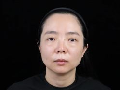 -素美医疗美容·西南眼鼻整形·修复基地