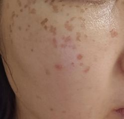 -深圳春天阳光医院·轮廓抗衰中心